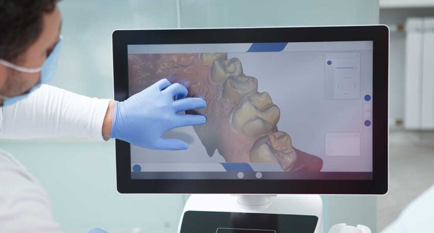 Nova Perio specialists Computer Guided Implant-Surgery